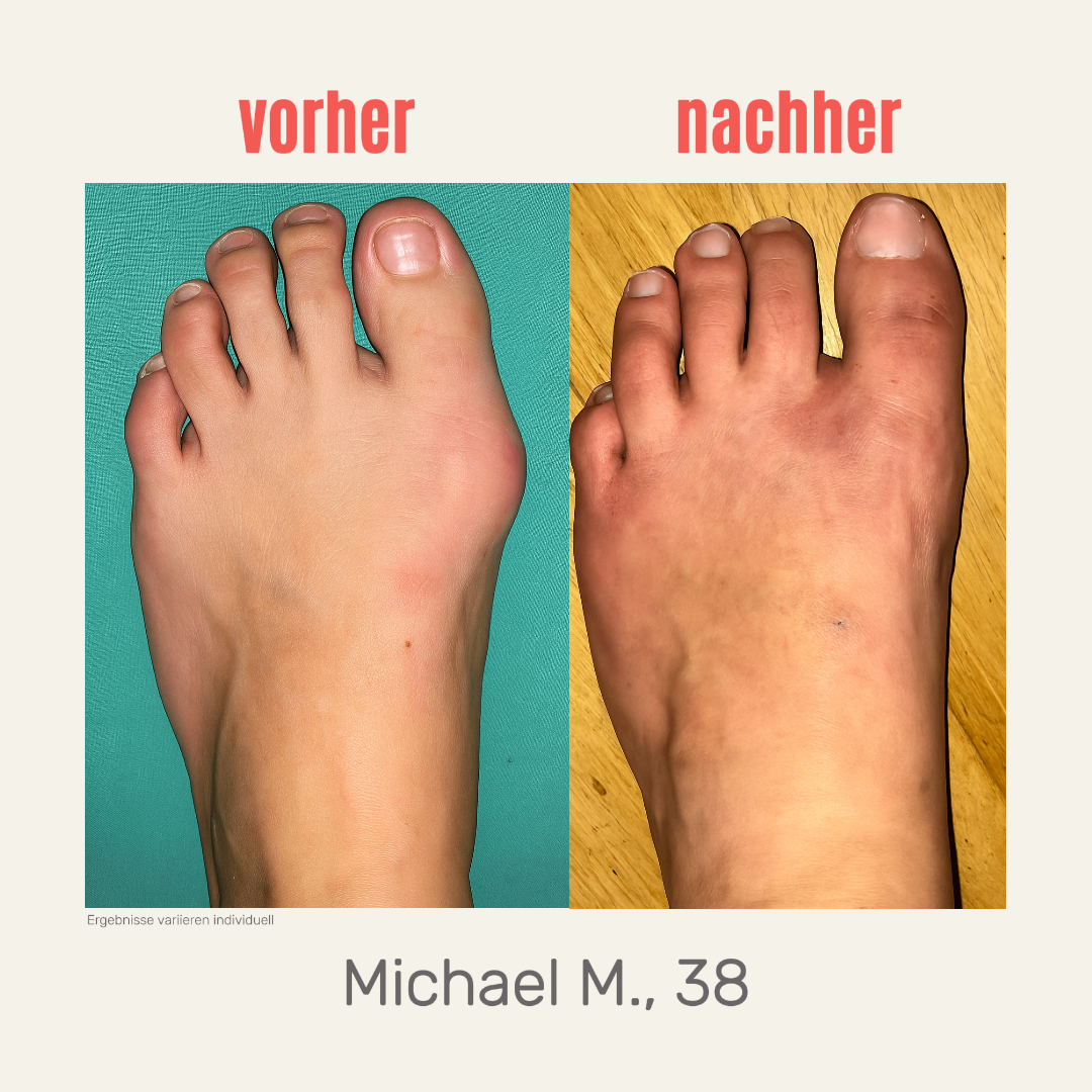 Endlich raus aus dem Schmerz - ganz ohne OP.