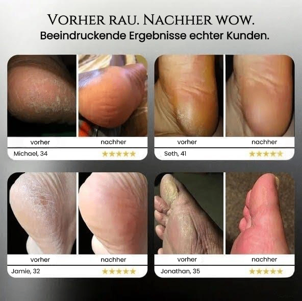 Für Füße, die du wieder lieben wirst. - Alenmo