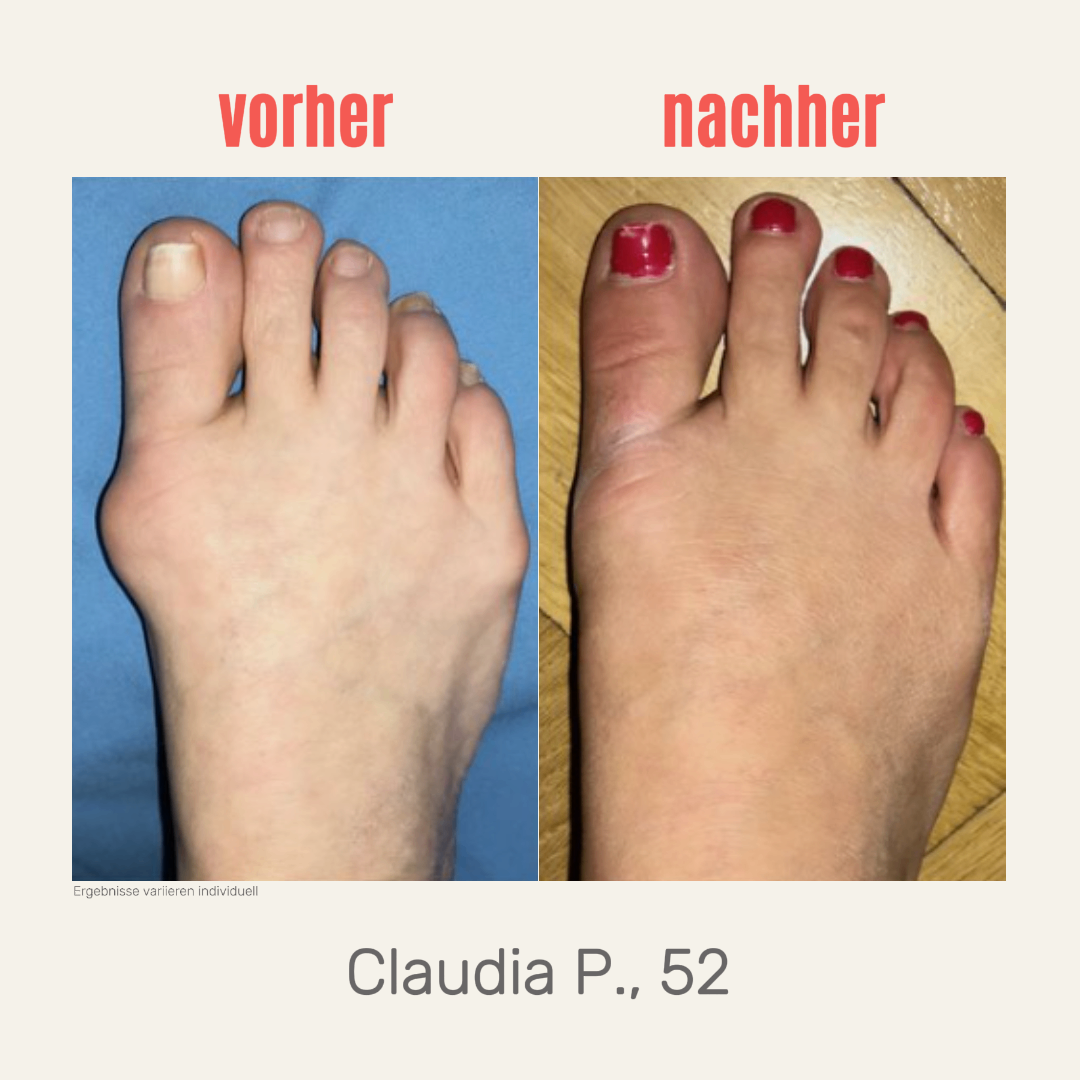 Endlich raus aus dem Schmerz - ganz ohne OP.